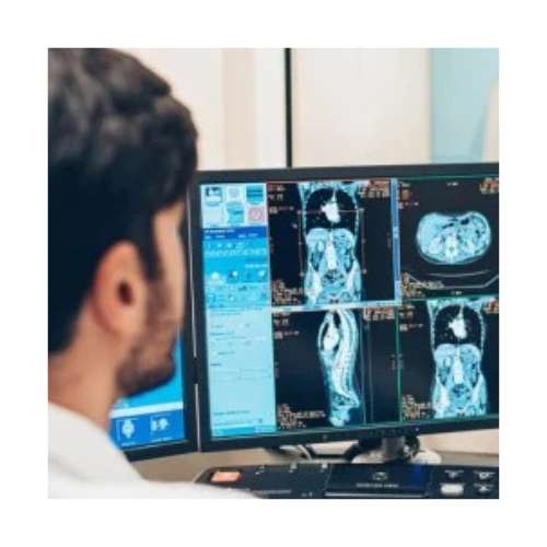 kp ultra sonography machine (2)